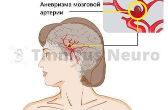bol-v-levoj-chasti-golovy-otdaet-v-uho-bol-v-golove-headnothurt-ru-2
