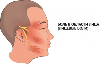 bol-v-polovine-golovy-i-litsa-bol-v-golove-headnothurt-ru-2