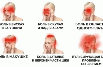 chem-snyat-bol-v-golove-pri-shejnom-osteohondroze-bol-v-golove-headnothurt-ru-2