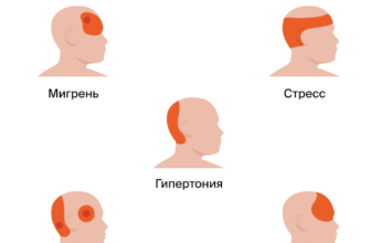 golova-mozhet-bolet-ot-nedosypaniya-iz-za-chego-mozhet-bolet-golova-headnothurt-ru-2