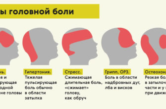 noyushhaya-bol-v-golove-v-oblasti-lba-bol-v-golove-headnothurt-ru-2
