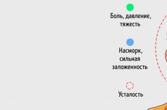 pochemu-bolit-golova-ot-tyazhesti-pochemu-bolit-golova-headnothurt-ru-2