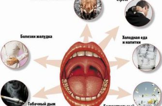 suhost-v-gorle-golovnaya-bol-golovnaya-bol-raznoe-headnothurt-ru-2