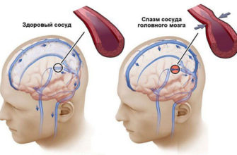 udarilas-golovoj-teper-bolit-i-kruzhitsya-kruzhitsya-golova-headnothurt-ru-2